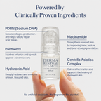 PDRN Advanced Infusion Treatment for Acne Scars