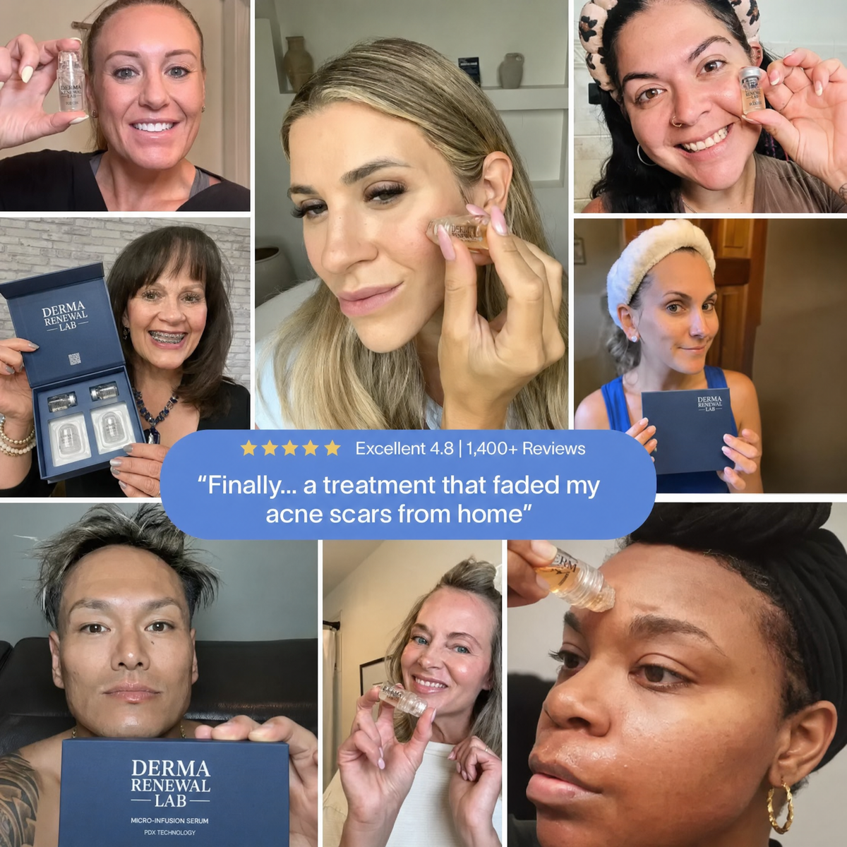 PDRN Advanced Infusion Treatment for Acne Scars