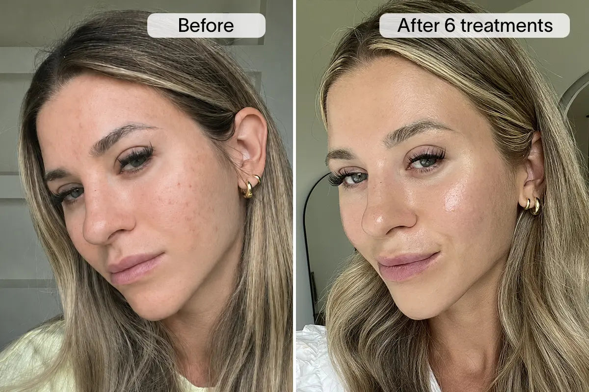 Ella I. before and after
