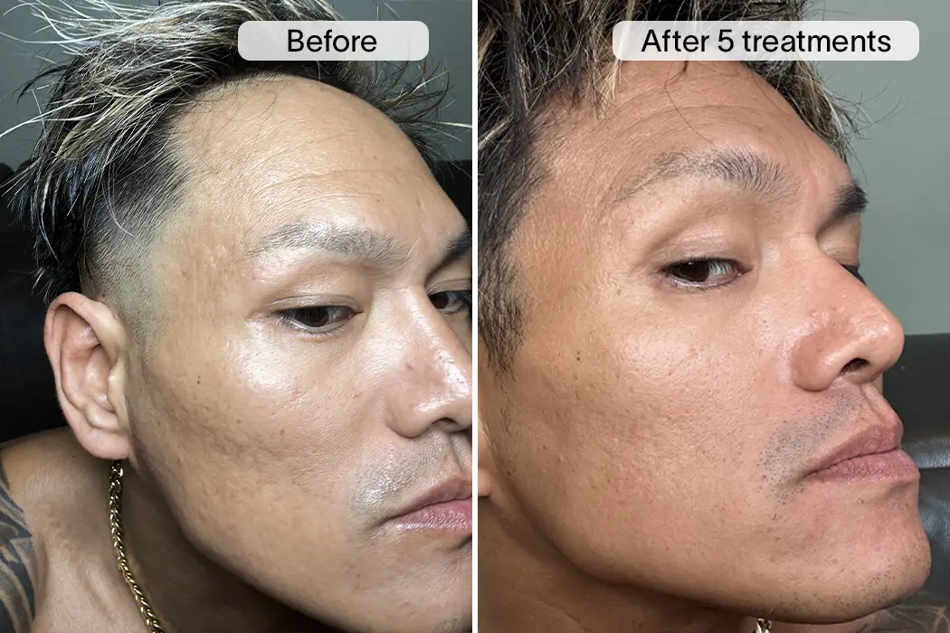 Reign S. before and after