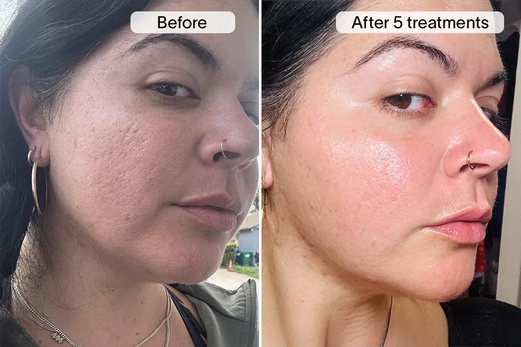 Stephanie P. before and after