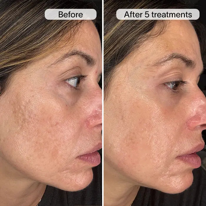 Before & After 4