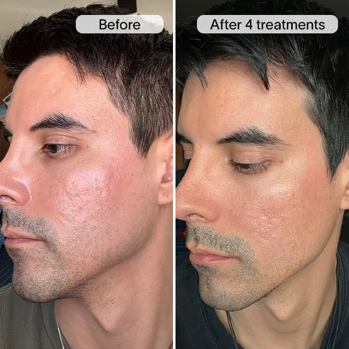 Before & After 3